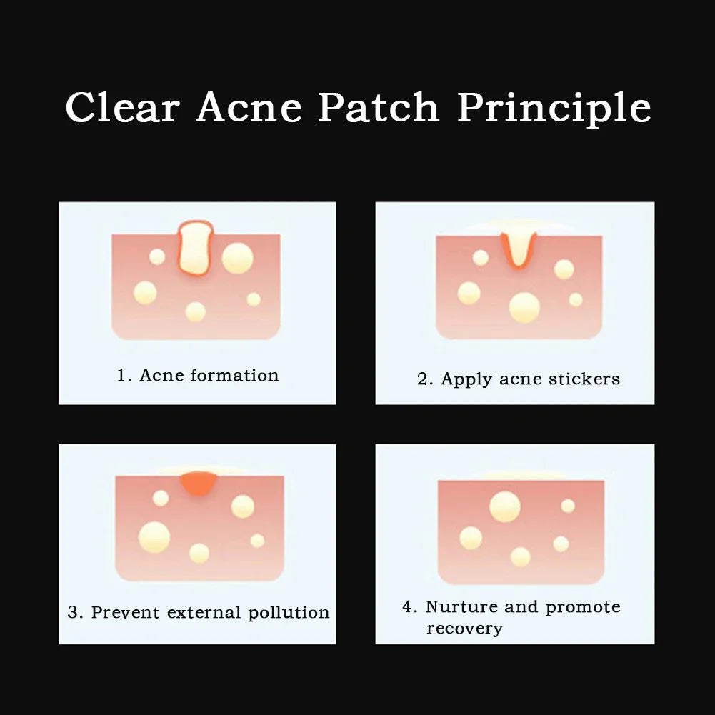 20/24pcs Hydrocolloid Acne Patches – Cute Cat-Themed Pimple Stickers (Golden Kitty, Snowy Paw, Holiday Cheer)