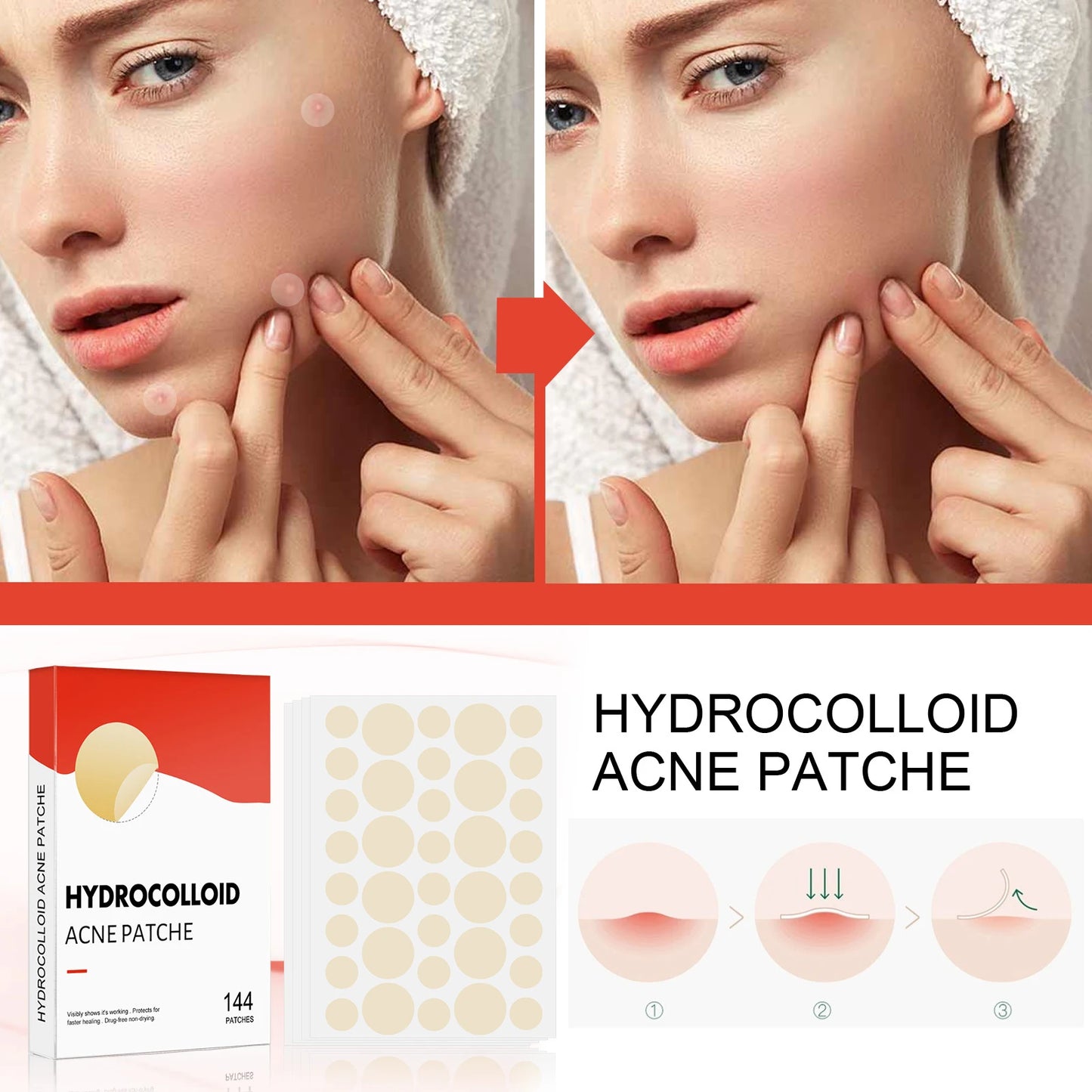 Hydrocolloid Acne Patch Invisible Closed Acne Patch Invisible Acne Face Invisible Waterproof Breathable Acne Skin Patch