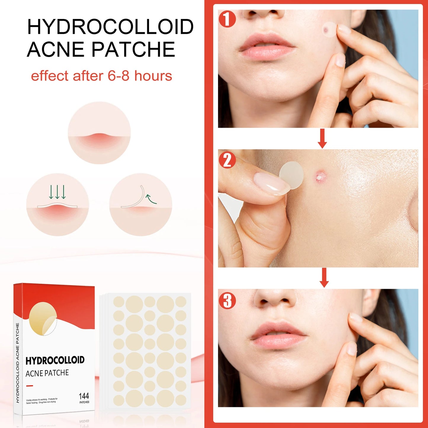 Hydrocolloid Acne Patch Invisible Closed Acne Patch Invisible Acne Face Invisible Waterproof Breathable Acne Skin Patch