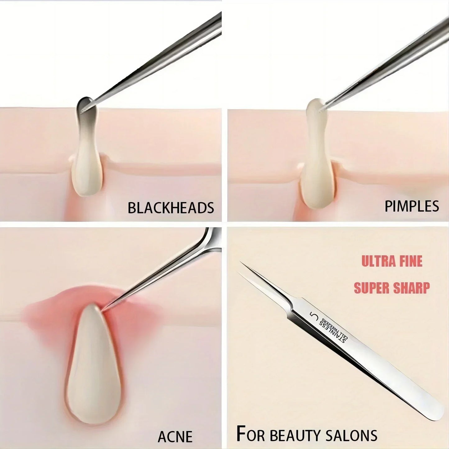 Precision Stainless Steel Acne & Blackhead Tweezers – Professional Skin Care Tool