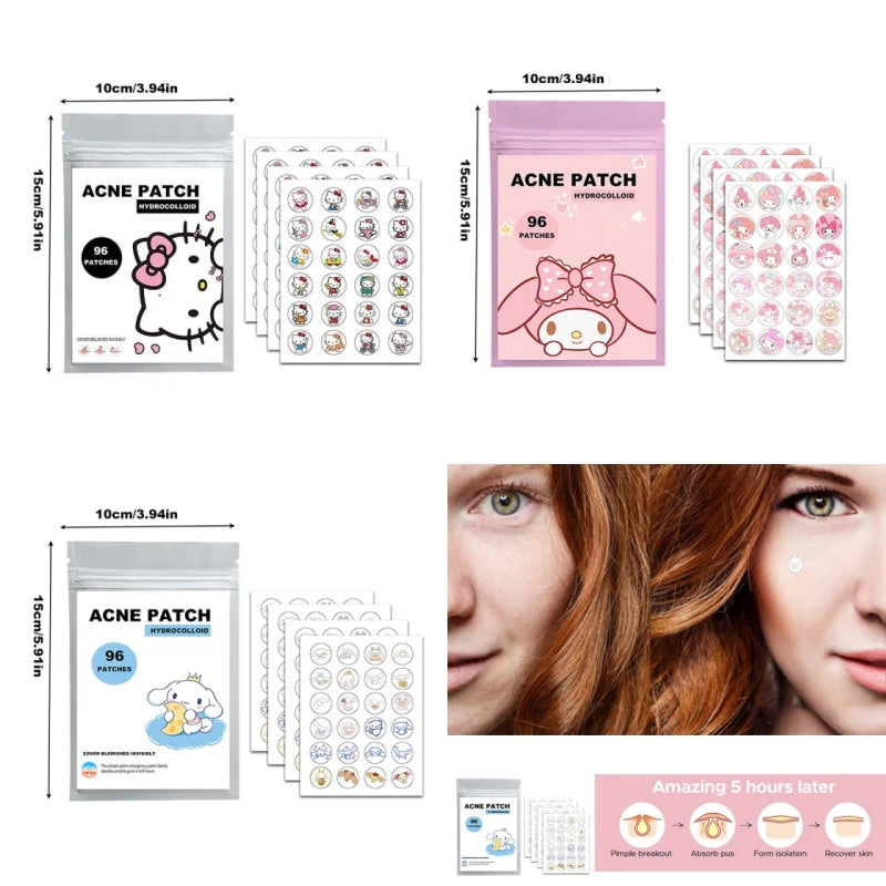 "96/100-Piece Hydrocolloid Acne Patches – Kawaii-Themed Pimple Treatment"