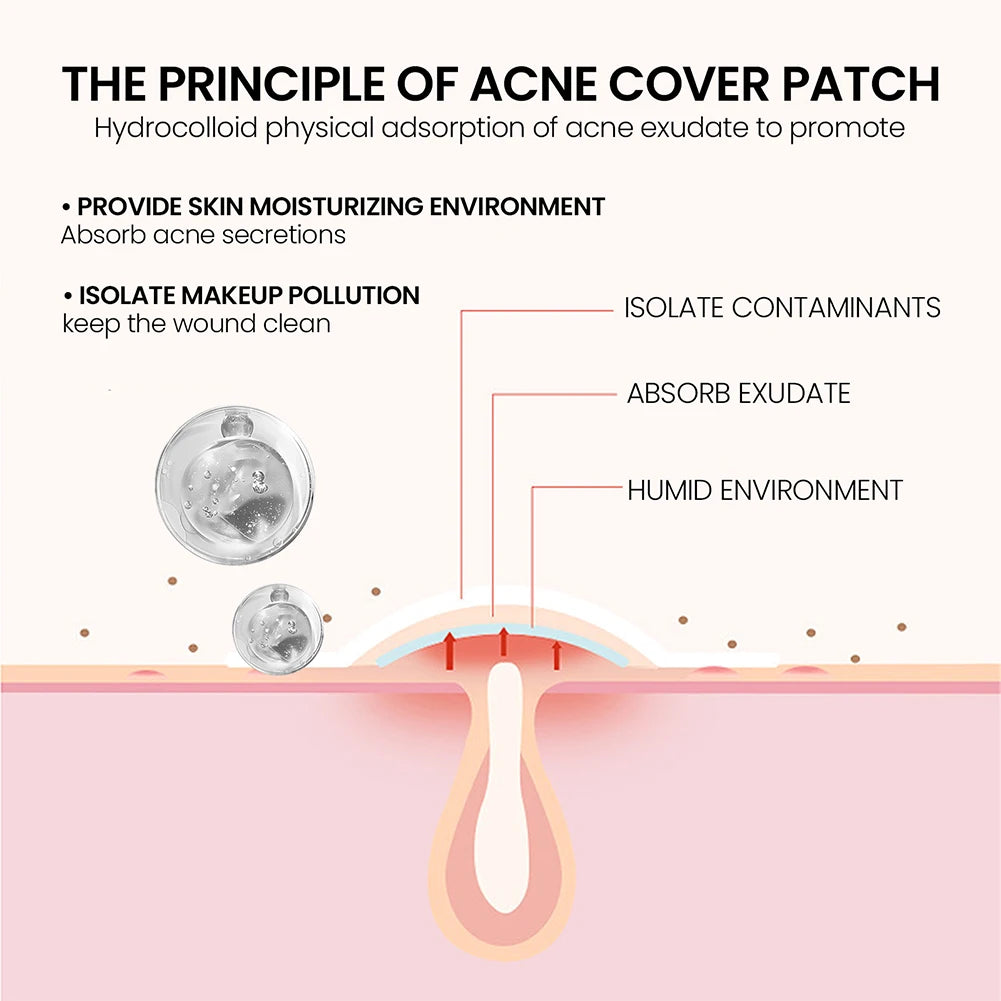 240pcs Hydrocolloid Acne Patches – Tea Tree & Salicylic Acid Spot Treatment (Star, Heart, Circle, Flower)